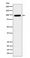 GLB1 Antibody